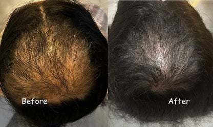 Garuda Rabit Herbal Hair Oil - 100% Effective!   Reviw  ⭐⭐⭐⭐☆ 735496